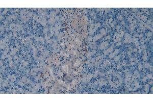 Detection of CHEM in Mouse Pancreas Tissue using Polyclonal Antibody to Chemerin (CHEM) (CHEM (AA 21-155) antibody)