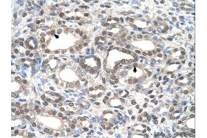 Immunohistochemistry (IHC) image for anti-Deafness, Autosomal Dominant 5 (DFNA5) (C-Term) antibody (ABIN2782489) (DFNA5 antibody  (C-Term))
