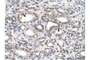 Immunohistochemistry (IHC) image for anti-Deafness, Autosomal Dominant 5 (DFNA5) (C-Term) antibody (ABIN310772) (DFNA5 antibody  (C-Term))