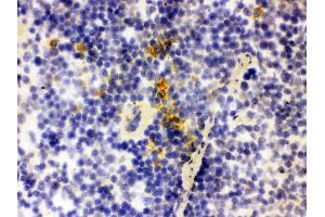 Immunohistochemistry (IHC) image for anti-Lipocalin 2 (LCN2) (AA 21-198) antibody (ABIN3043291)