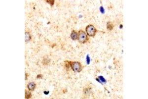 Immunohistochemical analysis of CARD11 staining in human brain formalin fixed paraffin embedded tissue section. (CARD11 antibody  (N-Term))