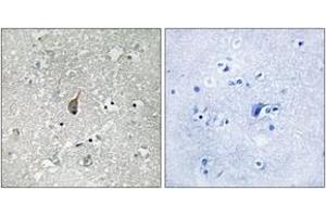 Immunohistochemistry analysis of paraffin-embedded human brain, using APC1 (Phospho-Ser355) Antibody. (APC1 antibody  (pSer355))