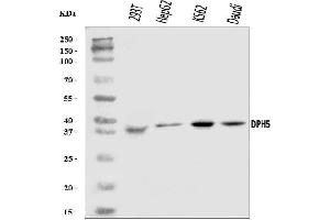 Western blot analysis of DPH5 using anti-DPH5 antibody (ABIN7599711). (DPH5 antibody  (AA 11-250))