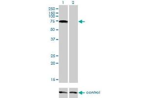Western blot analysis of PIAS2 over-expressed 293 cell line, cotransfected with PIAS2 Validated Chimera RNAi (Lane 2) or non-transfected control (Lane 1). (PIAS2 antibody  (AA 385-473))
