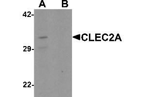Western blot analysis of CLEC2A in K562 cell lysate with CLEC2A antibody at 1 µg/mL in (A) the absence and (B) the presence of blocking peptide. (CLEC2A antibody  (N-Term))