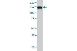 STAG2 monoclonal antibody (M01), clone 3C6 Western Blot analysis of STAG2 expression in Hela S3 NE . (STAG2 antibody  (AA 1130-1231))