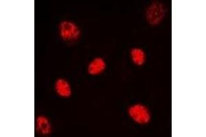 Immunofluorescent analysis of HNF4 alpha/gamma staining in HeLa cells. (HNF4 alpha/gamma antibody)