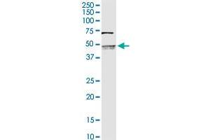 SERPINB2 MaxPab rabbit polyclonal antibody. (SERPINB2 antibody  (AA 1-415))