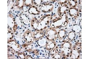 Immunohistochemical staining of paraffin-embedded Kidney tissue using anti-PSMC3 mouse monoclonal antibody. (PSMC3 antibody)