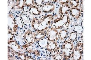 Immunohistochemical staining of paraffin-embedded Kidney tissue using anti-PSMC3 mouse monoclonal antibody.