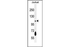 Western blot analysis of PDE3B Antibody (Center) in Jurkat cell line lysates (35ug/lane). (PDE3B antibody  (Middle Region))