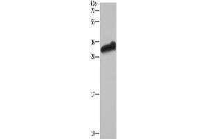 Western Blotting (WB) image for anti-Glutathione S-Transferase alpha 3 (GSTA3) antibody (ABIN2430213) (GSTA3 antibody)