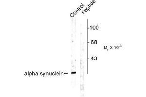 Image no. 1 for anti-Synuclein, alpha (SNCA) (pSer129) antibody (ABIN372588) (SNCA antibody  (pSer129))