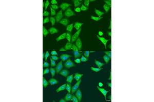 Immunofluorescence analysis of U2OS cells using PKR/PKR/EIF2 antibody (ABIN1679688 and ABIN3018462) at dilution of 1:100. (EIF2AK2 antibody)