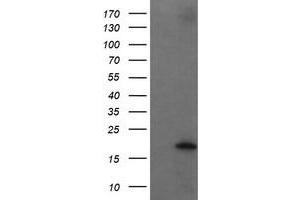 Image no. 10 for anti-Ubiquitin-Conjugating Enzyme E2G 2 (UBE2G2) antibody (ABIN1501634) (UBE2G2 antibody)