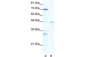WB Suggested Anti-HSF4 Antibody Titration:  5. (HSF4 antibody  (Middle Region))