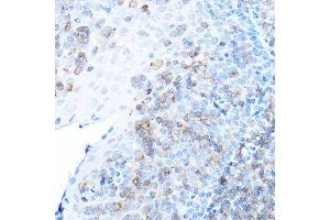 Immunohistochemistry of paraffin-embedded human tonsil using ULBP1 Rabbit pAb (ABIN6128898, ABIN6149917, ABIN6149918 and ABIN6214755) at dilution of 1:500 (40x lens). (ULBP1 antibody  (AA 26-216))