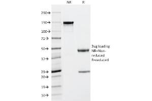 SDS-PAGE Analysis Purified Tryptase Mouse Monoclonal Antibody (TPSAB1/1963). (TPSAB1 antibody  (AA 115-233))