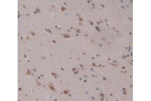 Used in DAB staining on fromalin fixed paraffin- embedded Kidney tissue (HOPX antibody  (AA 10-73))