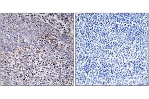 Immunohistochemistry analysis of paraffin-embedded human tonsil tissue, using Cytochrome c-type Heme Lyase Antibody. (HCCS antibody  (AA 81-130))