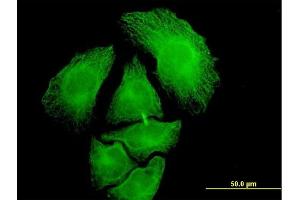 Immunofluorescence of monoclonal antibody to PGA5 on HeLa cell. (PGA5 antibody  (AA 203-306))