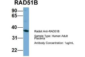 Host: Rabbit  Target Name: RAD51B  Sample Tissue: Human Adult Placenta  Antibody Dilution: 1.
