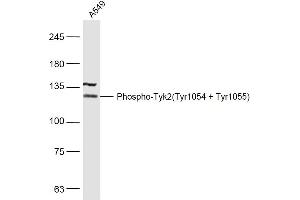 A549 lysates probed with Phospho-Tyk2(Tyr1054 + Tyr1055) Polyclonal Antibody, Unconjugated  at 1:500 dilution and 4˚C overnight incubation. (TYK2 antibody  (pTyr1054, pTyr1055))