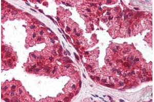 Human Prostate (formalin-fixed, paraffin-embedded) stained with PLEKHA8 antibody ABIN337060 at 2. (PLEKHA8 antibody  (AA 428-440))