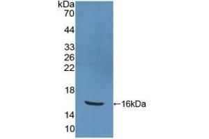 Detection of Recombinant PPARg, Human using Polyclonal Antibody to Peroxisome Proliferator Activated Receptor Gamma (PPARg) (PPARG antibody  (AA 157-274))