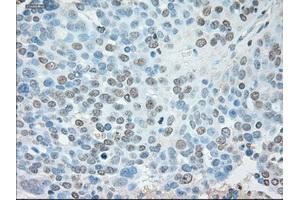 Immunohistochemical staining of paraffin-embedded Kidney tissue using anti-USP13mouse monoclonal antibody.