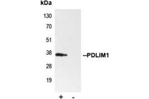 Immunoprecipitation (IP) image for anti-PDZ and LIM Domain 1 (PDLIM1) (Center) antibody (ABIN7297526)