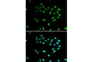Immunofluorescence analysis of A549 cell using SIRT1 antibody. (SIRT1 antibody)