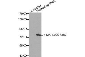 Western Blotting (WB) image for anti-Myristoylated Alanine-Rich Protein Kinase C Substrate (MARCKS) (pSer162) antibody (ABIN1870417) (MARCKS antibody  (pSer162))