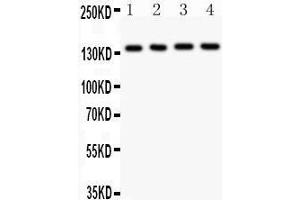 Anti- ABCB4 Picoband antibody, Western blotting All lanes: Anti ABCB4  at 0. (ABCB4 antibody  (AA 601-720))