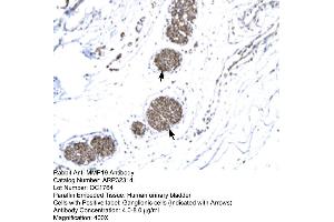 Human urinary bladder (MMP19 antibody  (N-Term))