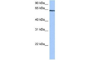 TTC6 antibody used at 0. (TTC6 antibody  (C-Term))