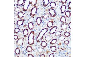 Immunohistochemistry of paraffin-embedded rat kidney using PDH Rabbit pAb (7432) at dilution of 1:100 (40x lens). (PDHA1 antibody)