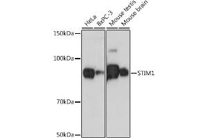 Western blot analysis of extracts of various cell lines, using STIM1 antibody (ABIN7270609) at 1:500 dilution. (STIM1 antibody)