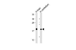 All lanes : Anti-VILIP1 Antibody at 1:4000 dilution Lane 1: Human brain lysate Lane 2: Human cerebellum lysate Lysates/proteins at 20 μg per lane. (VSNL1 antibody)