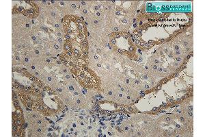 Immunohistochemistry (IHC) image for anti-Hydroxysteroid (11-Beta) Dehydrogenase 2 (HSD11B2) (AA 151-250) antibody (ABIN701680)