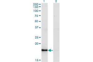 Western Blot analysis of ZMAT4 expression in transfected 293T cell line by ZMAT4 monoclonal antibody (M02), clone 2A4. (ZMAT4 antibody  (AA 1-153))