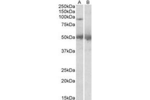 AP31417PU-N USP6 antibody staining of Human Placenta lysate at 2 µg/ml (35 µg protein in RIPA buffer) with (B) and without (A) blocking with the immunizing peptide.