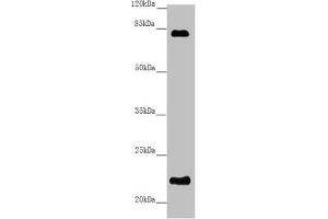 Western blot All lanes: REEP1 antibody at 5. (Receptor Accessory Protein 1 antibody  (AA 101-201))