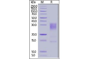 Human IL-13, His Tag on  under reducing (R) condition. (IL-13 Protein (AA 21-132) (His tag))