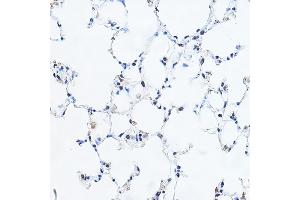 Immunohistochemistry of paraffin-embedded mouse lung using YE Rabbit pAb (ABIN6130808, ABIN6150331, ABIN6150332 and ABIN6221925) at dilution of 1:100 (40x lens). (GAS41 antibody  (AA 1-227))