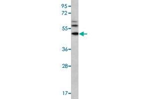 Western blot analysis of MDA-MB-435 cell lysate (35 ug/lane) with MMP16 polyclonal antibody . (MMP16 antibody  (N-Term))
