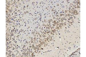 IHC analysis of RPL10 using anti-RPL10 antibody (ABIN7601177). (RPL10 antibody  (AA 3-214))