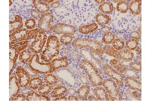 This image was generously provided by Xi Qiao from the Second Hospital of Shanxi Medical University. (RAMP1 antibody  (AA 118-148))