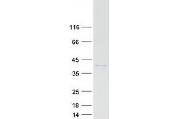 CHMP4B Protein (Myc-DYKDDDDK Tag)