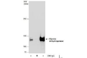IP Image Immunoprecipitation of Glycine dehydrogenase protein from HepG2 whole cell extracts using 5 μg of Glycine dehydrogenase antibody [N3C2-2], Internal, Western blot analysis was performed using Glycine dehydrogenase antibody [N3C2-2], Internal, EasyBlot anti-Rabbit IgG  was used as a secondary reagent. (GLDC antibody)